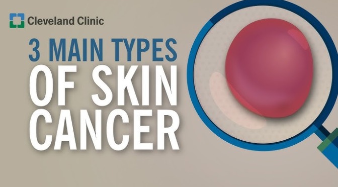 Skin Cancer: The 3 Main Types (Cleveland Clinic)