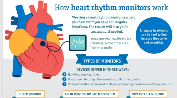 Infographic: How Heart Rhythm Monitors Work