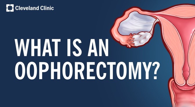 Women’s Health: What Is An Oophorectomy?