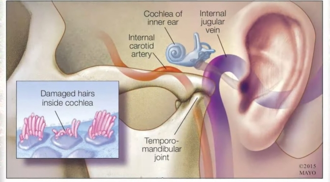 Ear Health: Diagnosing And Managing ‘Tinnitus’