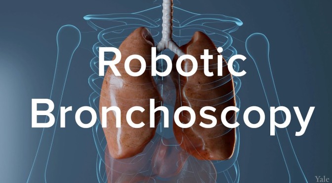 Lung Cancer: Benefits Of Robotic Bronchoscopy